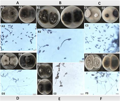 煤污病|紫薇煤污病病原分离鉴定及 分子生物学检测